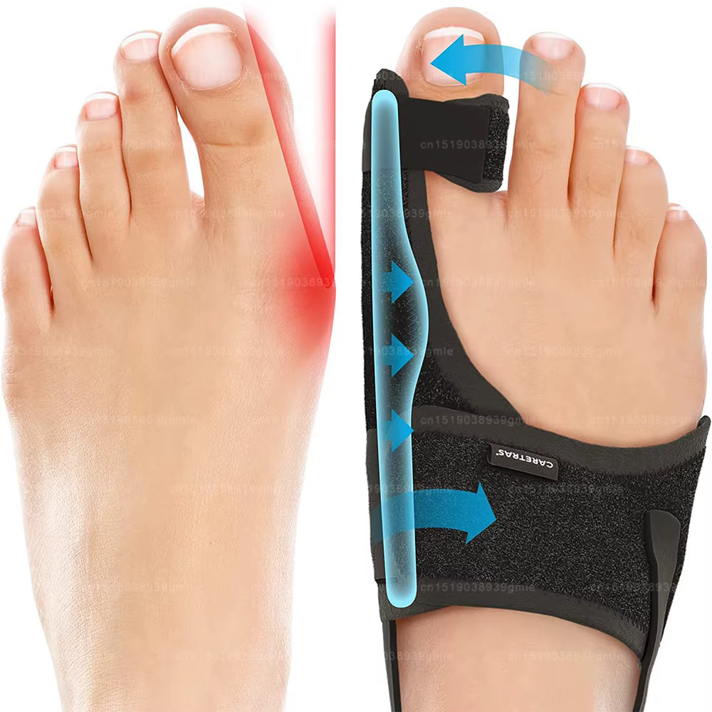 Correcteur de Hallux Valgus, Redresseur de gros orteil confortable avec coussinets et attelle pour H